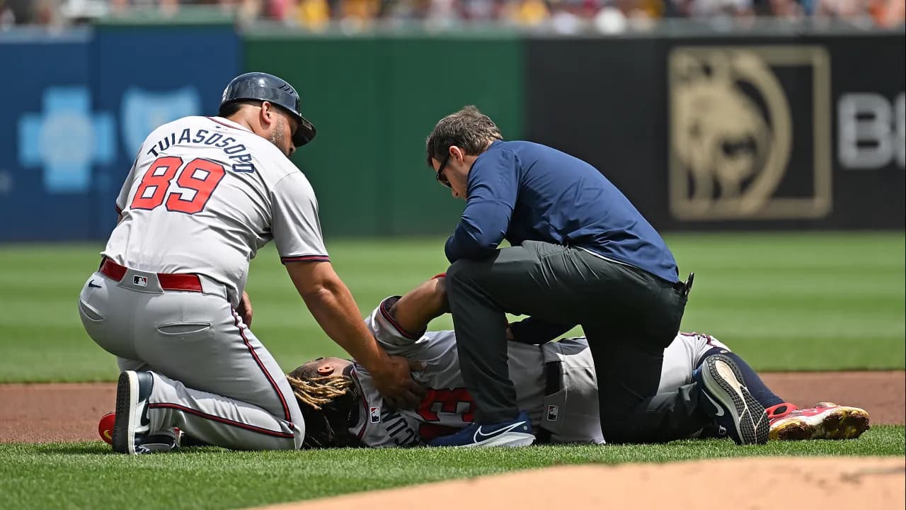 Acuña leaves game after fouling ball off leg, Braves await diagnosis